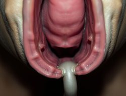 Mengenal Penyakit Akalasia: Gejala dan Penanganannya